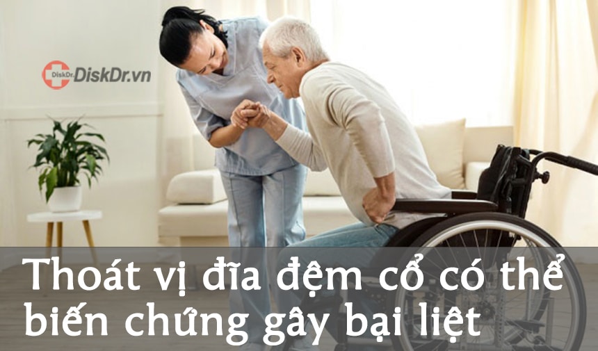 Biến chứng nguy hiểm nhất của thoát vị đĩa đệm là bại liệt