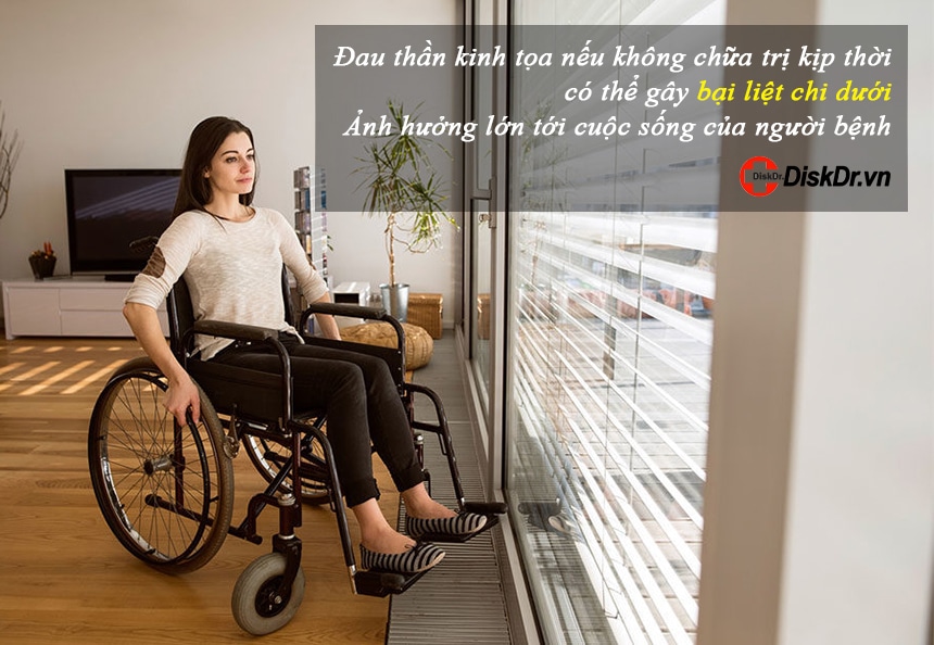 Biến chứng nặng nhất của đau thần kinh tọa là bại liệt chi dưới