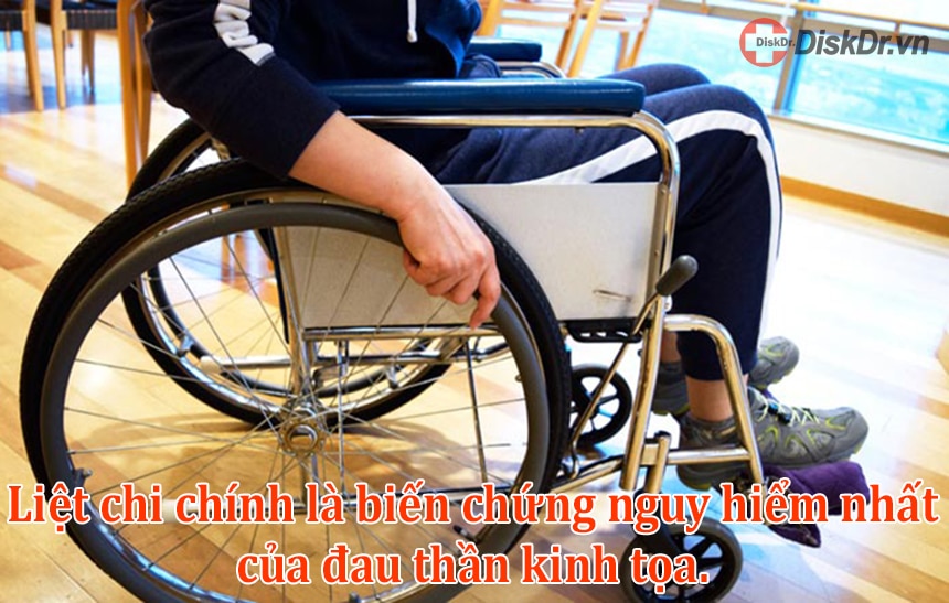 Liệt chi được coi là biến chứng nguy hiểm nhất