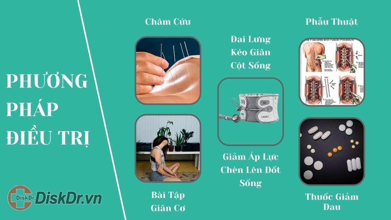 Phương pháp điều trị thoái hóa cột sống, gai cột sống, thoát vị đĩa đệm