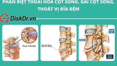 Phân biệt thoát hóa cột sống, gai cột sống và thoát vị đĩa đệm