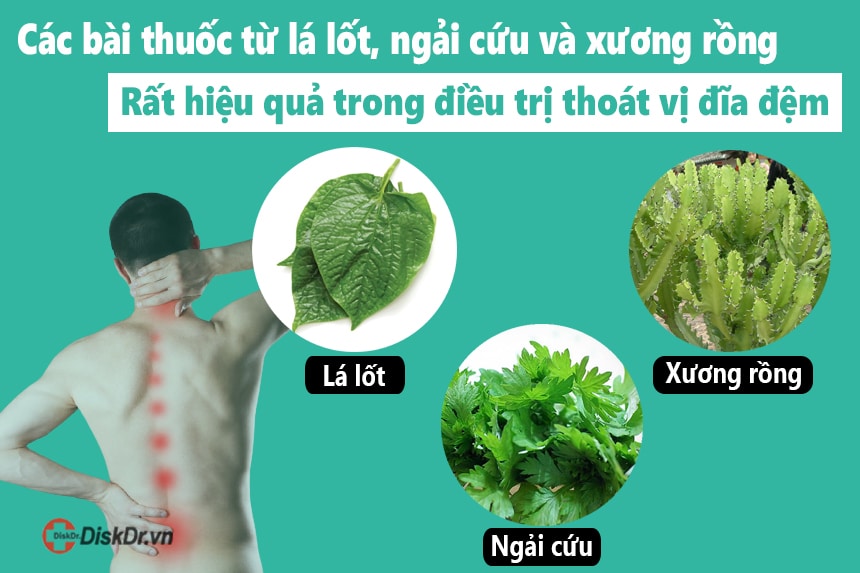 Điều trị thoát vị đĩa đệm hiệu quả bằng thuốc nam