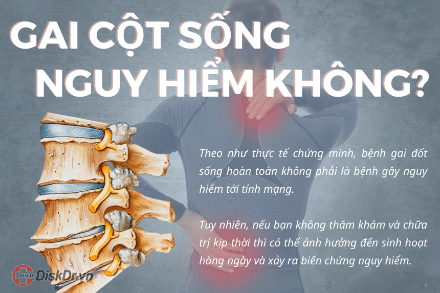 Gai cột sống nguy hiểm không?