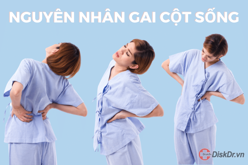 Nguyên nhân gai cột sống