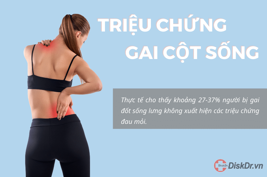 Triệu chứng gai cột sống