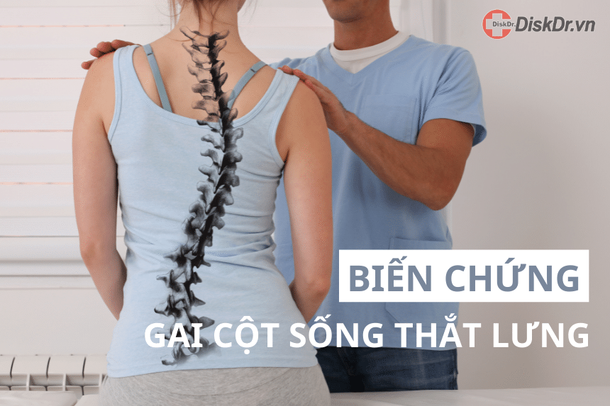 Biến chứng gai cột sống thắt lưng