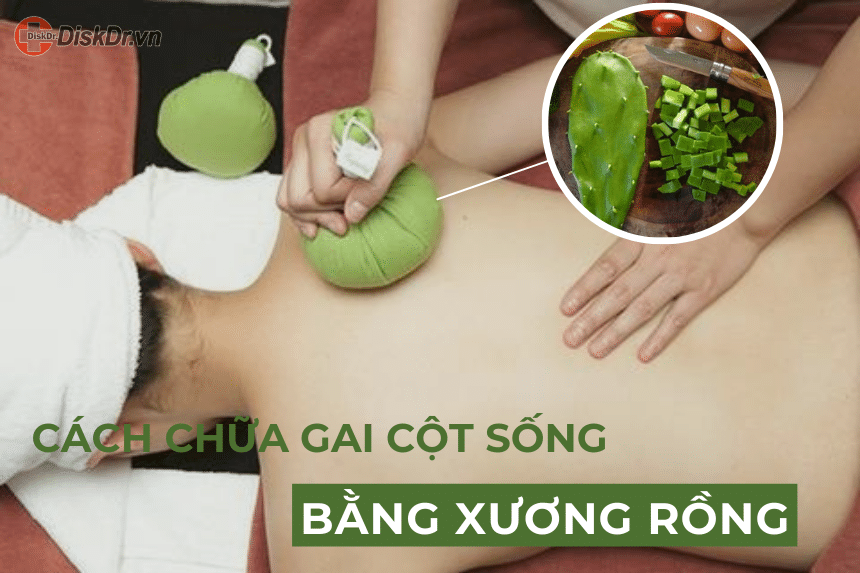 Cách chữa gai cột sống bằng xương rồng