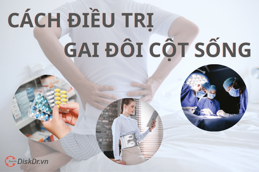 Cách điều trị gai đôi cột sống