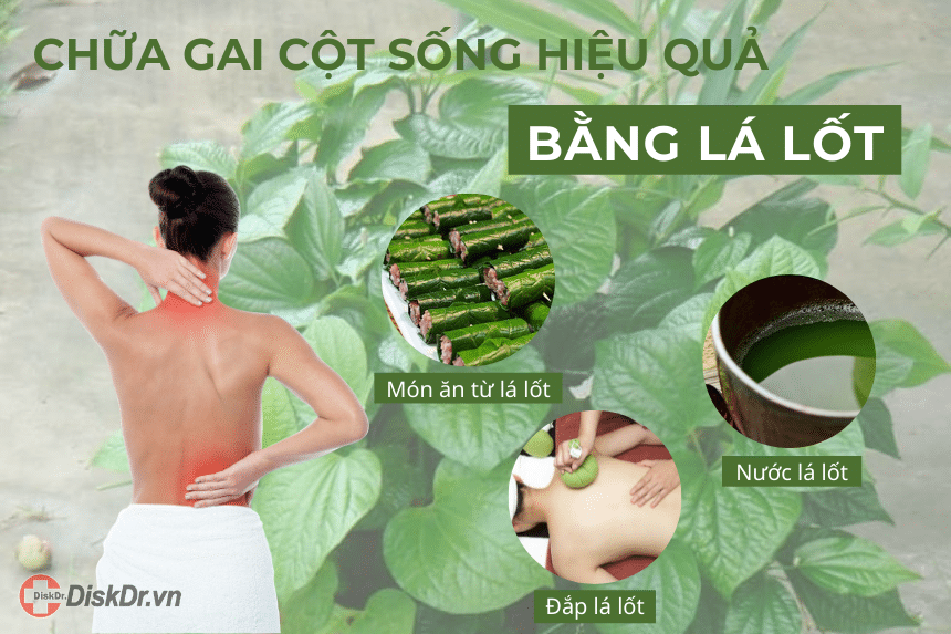 Chữa gai cột sống hiệu quả bằng lá lốt