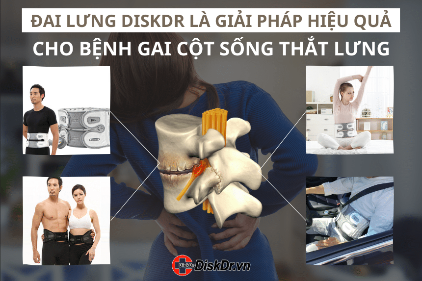 Đai lưng DiskDr Hàn Quốc là giải pháp hiệu quả cho người bệnh