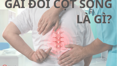 Gai đôi cột sống là gì