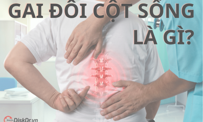 Gai đôi cột sống là gì