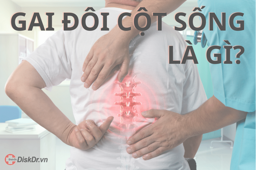 Gai đôi cột sống là gì