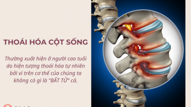 Thoái hóa cột sống