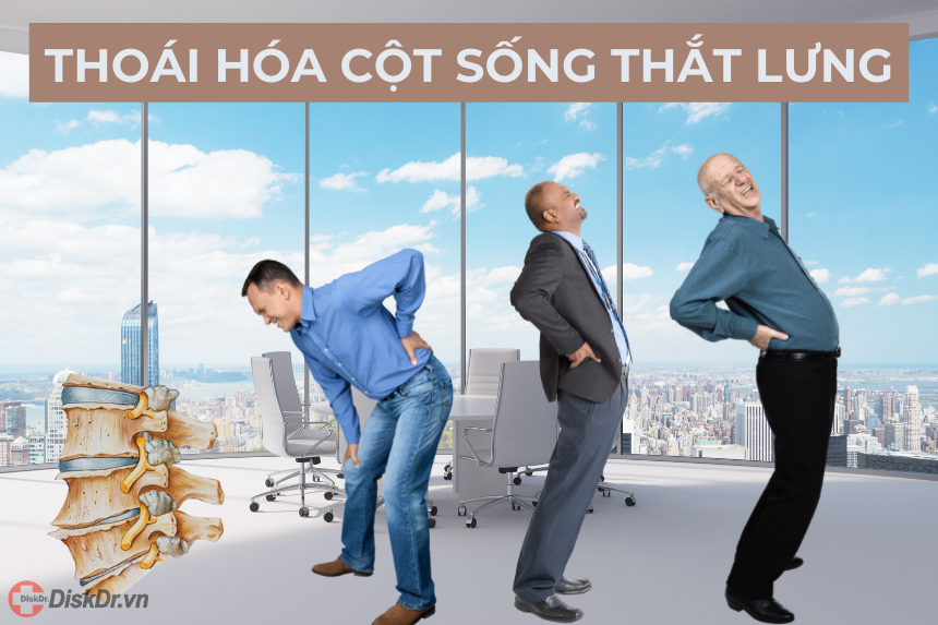 Thoái hóa cột sống thắt lưng