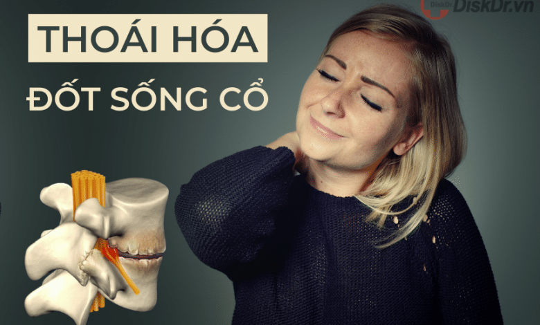 Thoái hóa đốt sống cổ