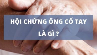 Hội chứng ống cổ tay là gì?