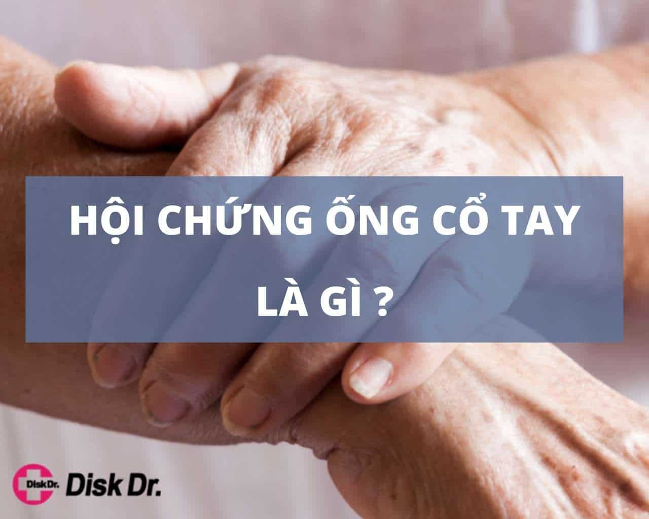 Hội chứng ống cổ tay là gì?