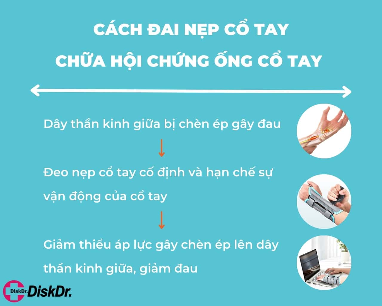 Cách điều trị hội chứng ống cổ tay