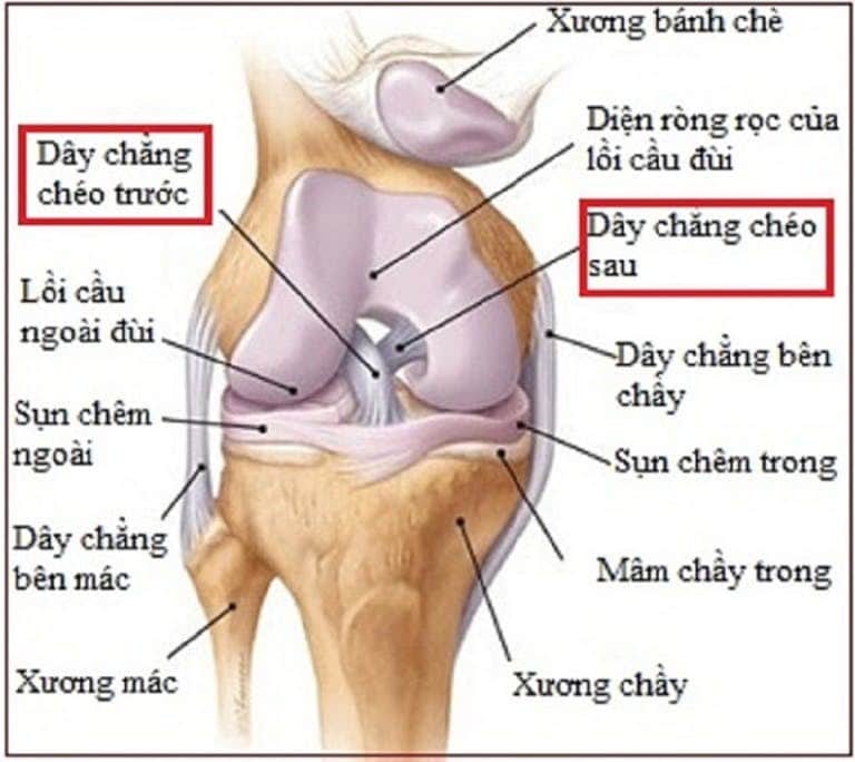 Biến chứng từ đứt dây chằng chéo trước