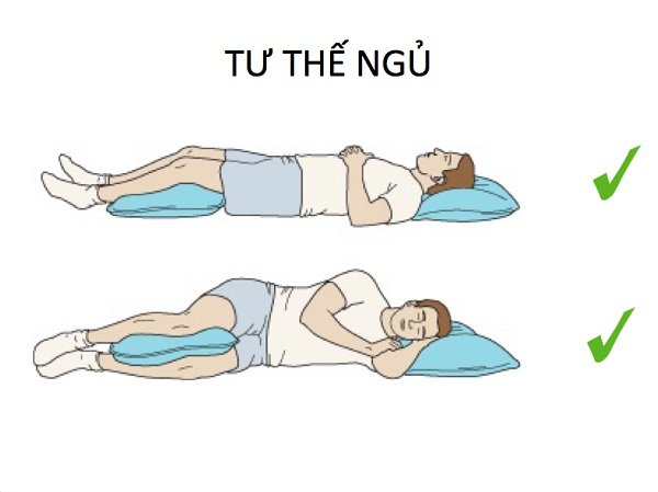 Bạn nên nằm ngửa khi ngủ và dùng một chiếc gối nhỏ ở dưới đầu gối để giữ được độ cong cho phần hông