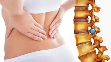 Nếu thoát vị đĩa đệm đa tầng xảy ra ở phần cột sống thì người bệnh sẽ có cảm giác các cơn đau lan xuống từ thắt lưng, hông và chân