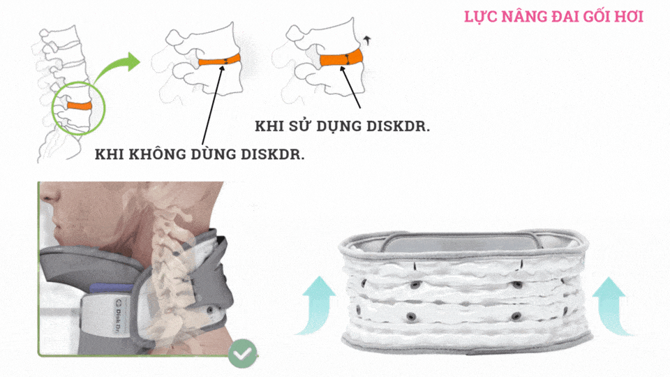 Nguyên lý hoạt động 3 sản phẩm DiskDr