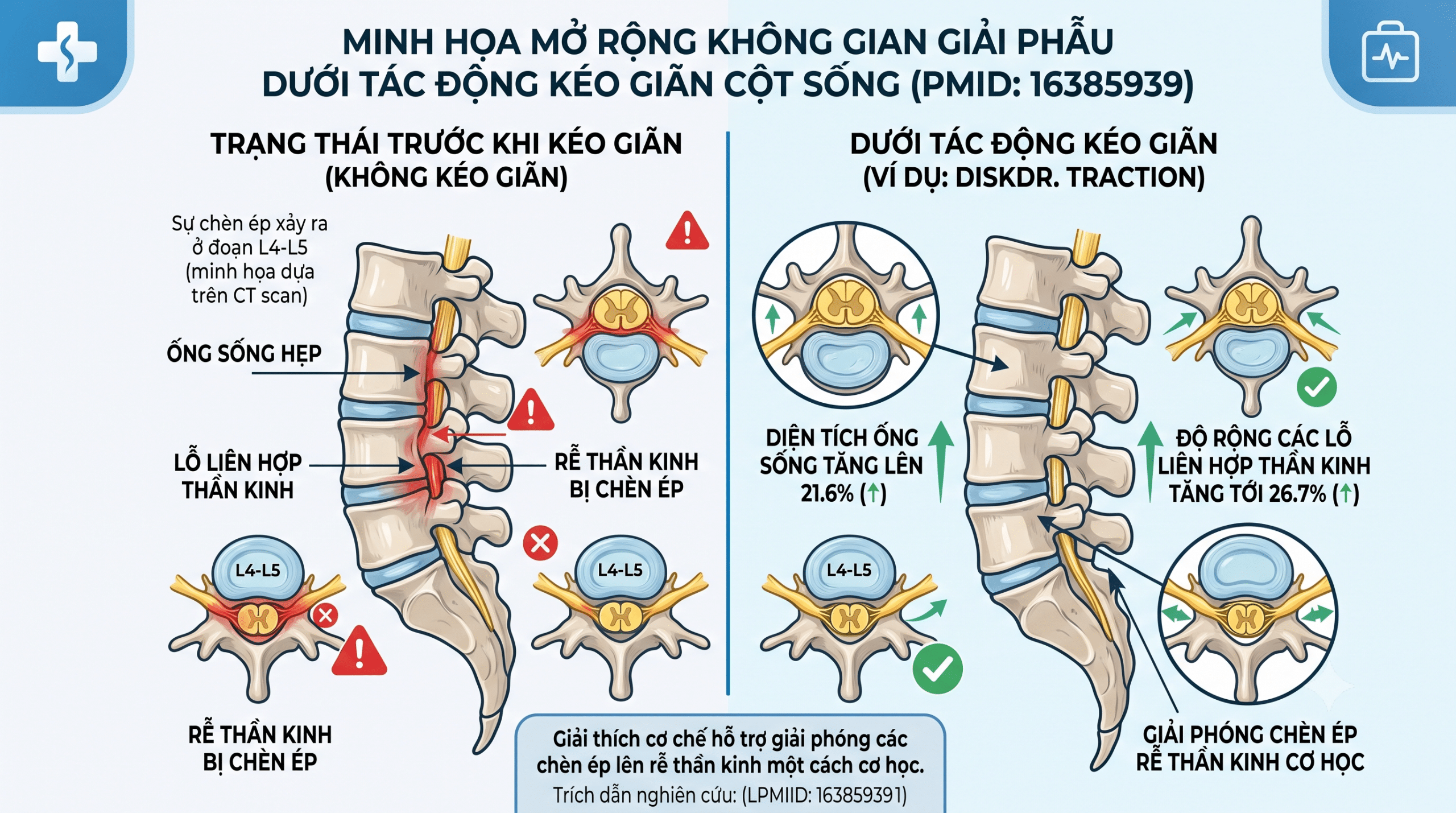 Nghiên cứu đo lường bằng chụp CT (PMID 16385939)